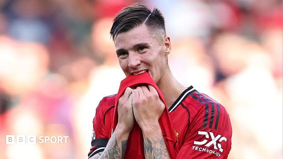 Benjamin Sesko Absen Panjang, Manchester United Hadapi Krisis Lini Depan